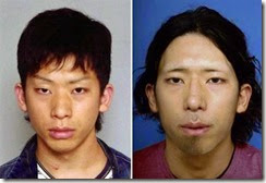 ichihashi-surgery ichihashi-surgery
