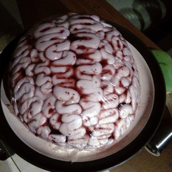 cerebro cerebro