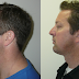 Chin1.png