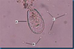 04_Amoeba_sml 04_Amoeba_sml
