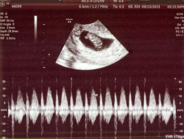 Baby-3-9weeks-2blog.jpg
