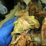 spleen_pancreas.JPG