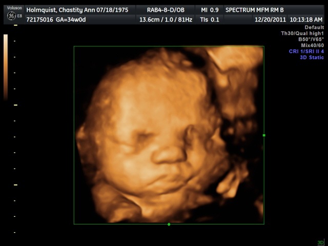 [Holmquist_Chastity%2520%252012-20-11_10%255B4%255D.jpg]