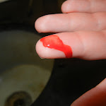 blood_on_finger.JPG