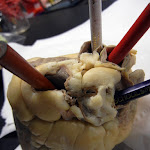 heart_back_pulmonary_vena_cava.JPG