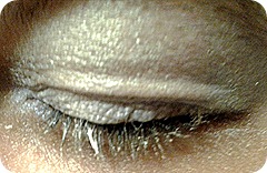 starlooksrighteye starlooksrighteye