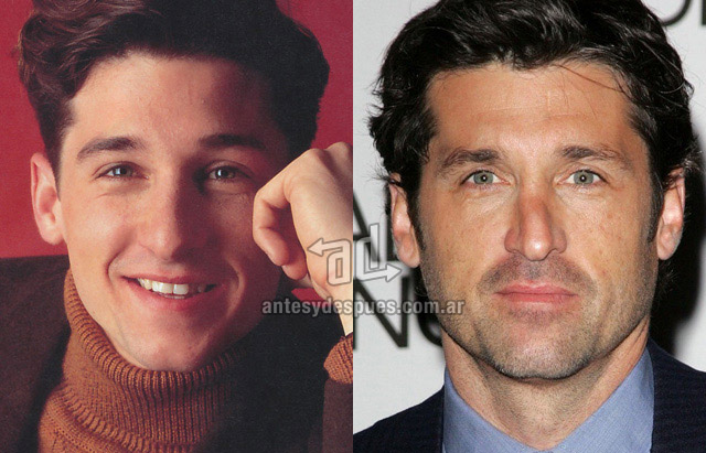 La nueva nariz operada de Patrick Dempsey