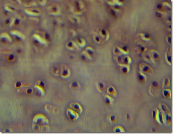 Hyaline cartilage highly magnified microscopy