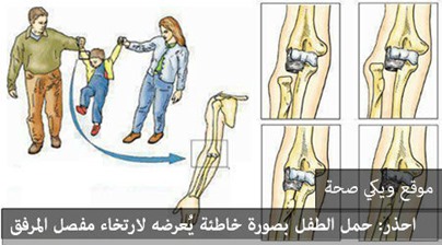 احذر: حمل الطفل بصورة خاطئة يُعرضه لارتخاء مفصل المرفق احذر: حمل الطفل بصورة خاطئة يُعرضه لارتخاء مفصل المرفق