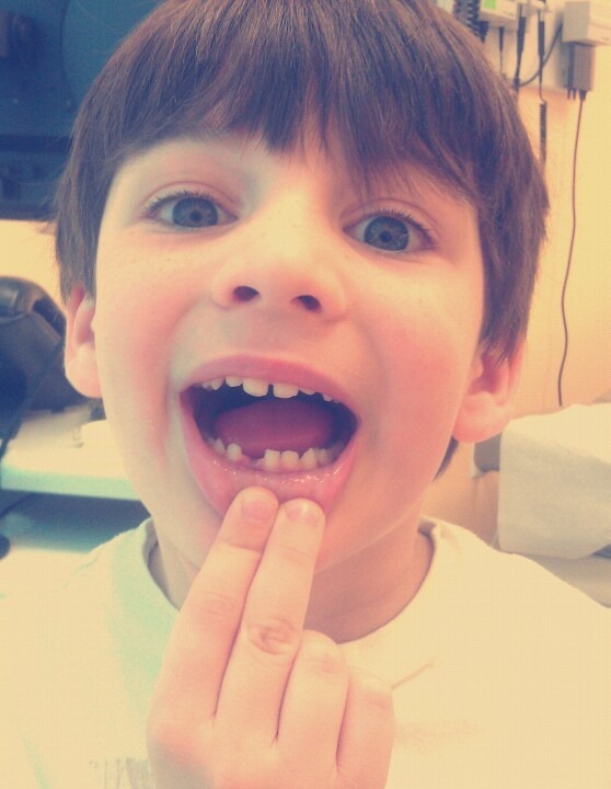 [first-tooth%255B10%255D.jpg]