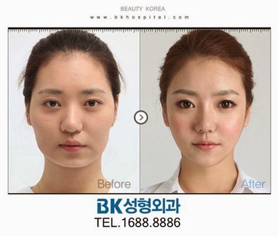 [korean-plastic-surgery-17%255B2%255D.jpg]