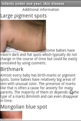 Disease skin in infants