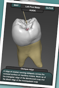 How to mod Real Tooth Morphology 3.2 mod apk for android