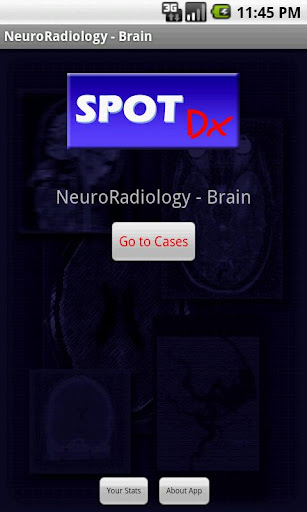 NeuroRadiology - Brain