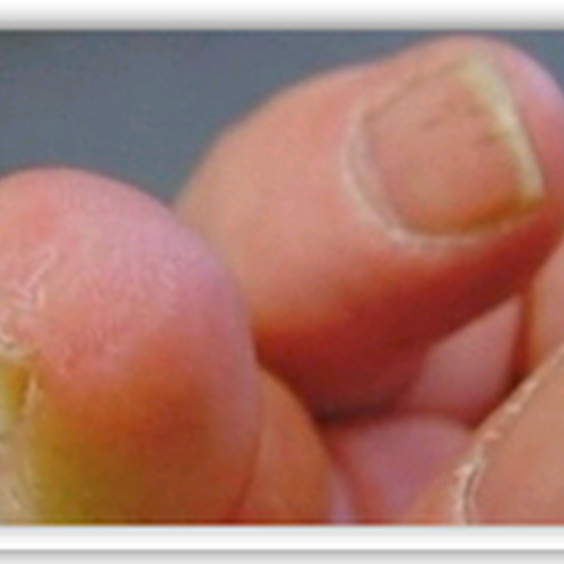 Regenerative Medicine – Material and Cell Based Regeneration of the Human Body