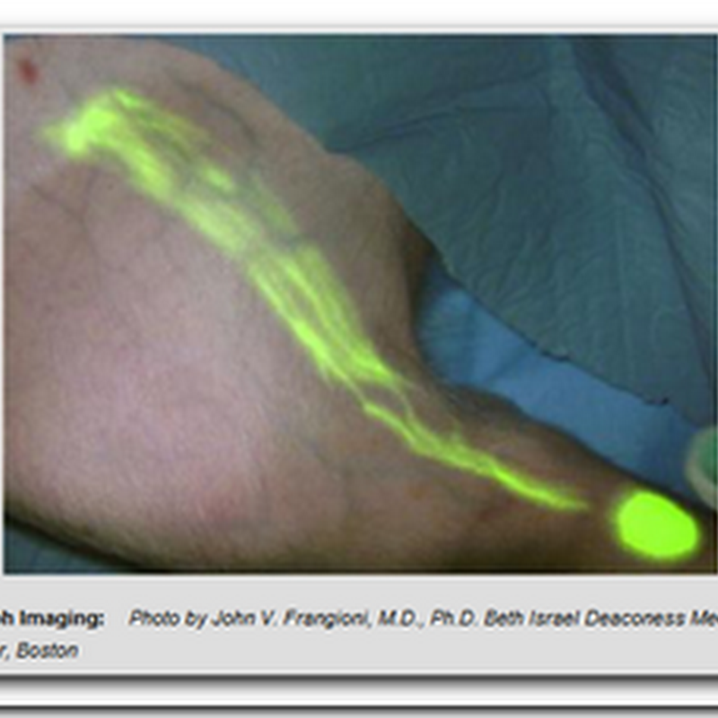 Surgery By Numbers - Glowing Cancer Cells