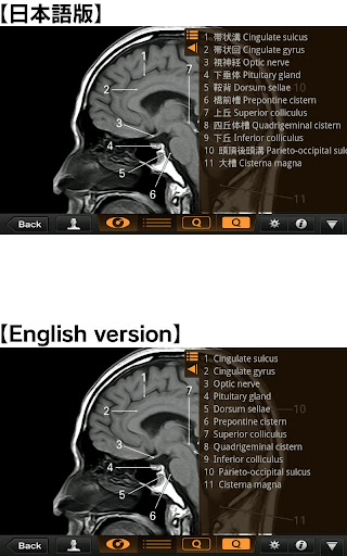 【免費醫療App】Interactive CT & MRI Anat.Lite-APP點子