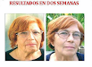 Terapia De Rejuvenecimiento Sin Cirugia