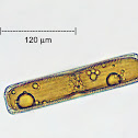 Diatom