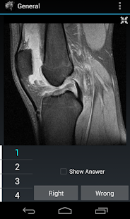 How to mod Radiology Flashcards: General lastet apk for laptop