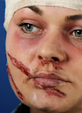 Classification and Assessment of People with Head Injuries