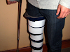 Inmovilizador De Rodilla  Regalo  G