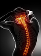 Spinal Trauma: Modern Nursing Care and Appropriate Treatment