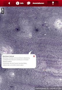 How to download Smart Hematology Lite patch 1.1.1 apk for pc