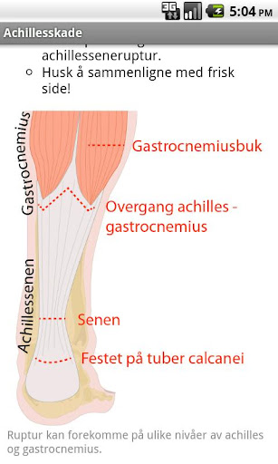 Turnuslegens ABC