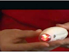 Terapia Laser Antiedad