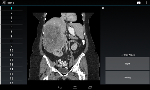 How to get Radiology Flashcards: Body 3 1.4 mod apk for bluestacks