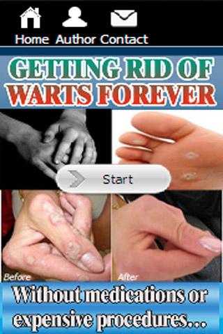 Getting Rid Of Warts Forever