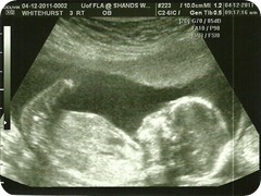 Baby 3 Profile @ 17 weeks