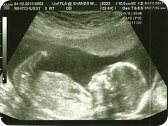 Baby 3 Profile @ 17 weeks Baby 3 Profile @ 17 weeks