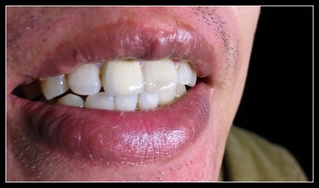 teeth