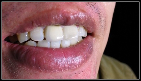 [teeth[8].jpg]