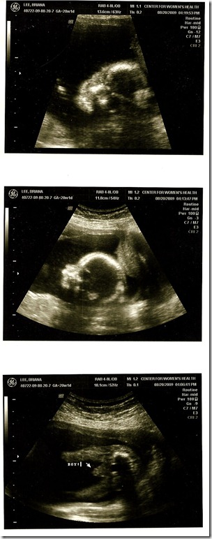 ultrasound
