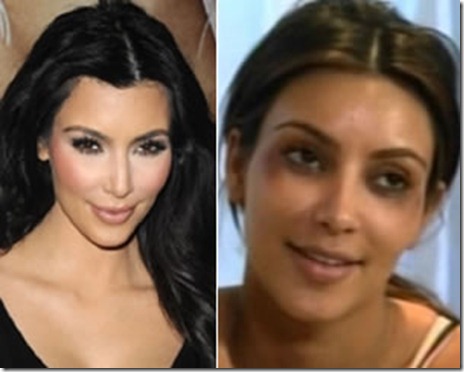 kardashianbotox kardashianbotox