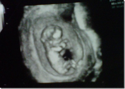 baby13wks