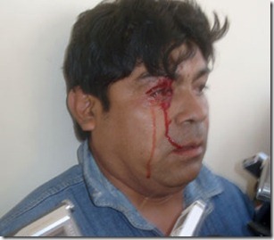 agresion.prensa