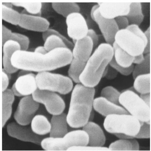 Escherichia coli is a type of bacteria that lives in the intestinal tract, aiding the digestive process by suppressing the growth of harmful bacteria and synthesizing vitamins. 