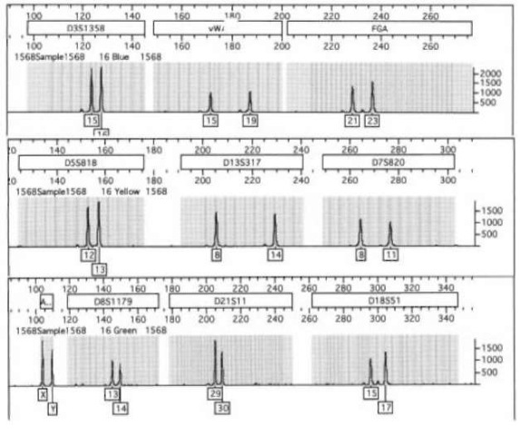  A single analysis of a blood sample amplified using the Profiler+ (Perkin-Elemer) PCR amplification kit.