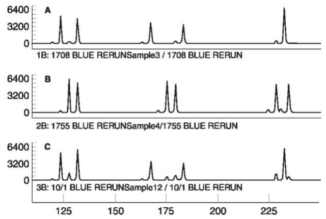 The analysis of a mixed sample of DNA using the AmpFISTR blue STR kit (Perkin-Elemer). Panels A and B contain individual samples. Sample C is a mixture with sample B as the minor component. Note the effect of stutter peaks on the relative size of the alleles. Conditions as in Figure 4.