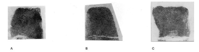 Fingerprint patterns: (A) arch; (B) loop; (C) whorl.
