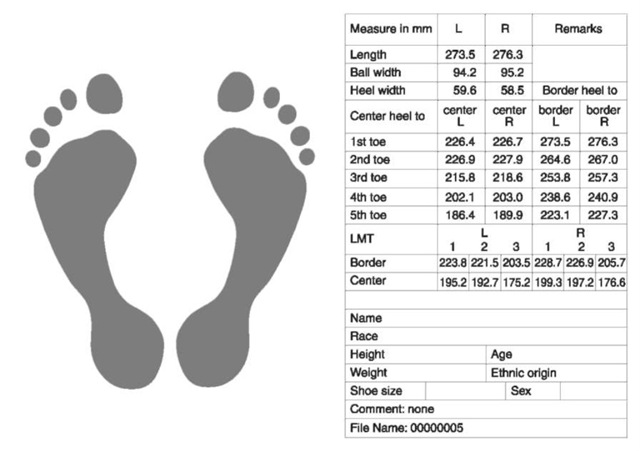  Printout from computer database showing the tracing of the weight-bearing areas of a pair of bare feet. The data box shows some of the data gathered by the computer and the history box shows the personal information of the individual. LMT, length of metatarsal.
