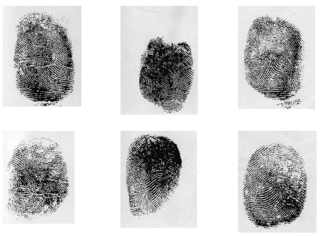 Thumbprints of identical triplets.