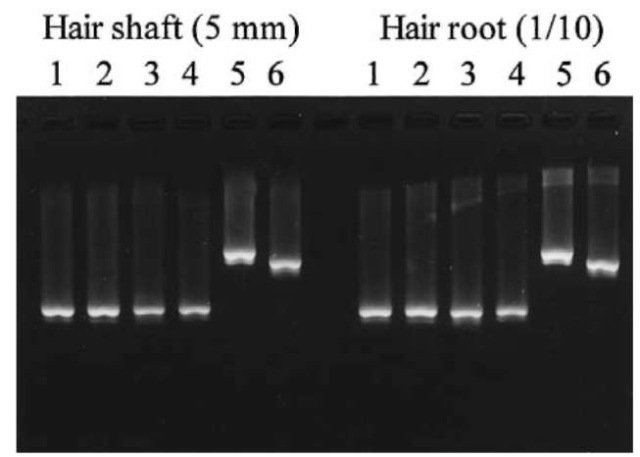 Agarose gel electrophoresis of PCR of mtDNA extracted from head telogen hair. Template DNA corresponds to the amount of DNA extracted from a 5mm length of the hair shaft and one-tenth of the hair root. Primer pair: 1; A1/B2, 2; A2/B1, 3; C1/D2, 4; C2/D1, 5; A1/B1, 6; C1/D1.