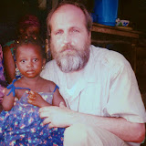  &ndash; Child with amputated arm and mutilated hand, May 2000.... © 2008 Nazareth House Media, JBM Photographer