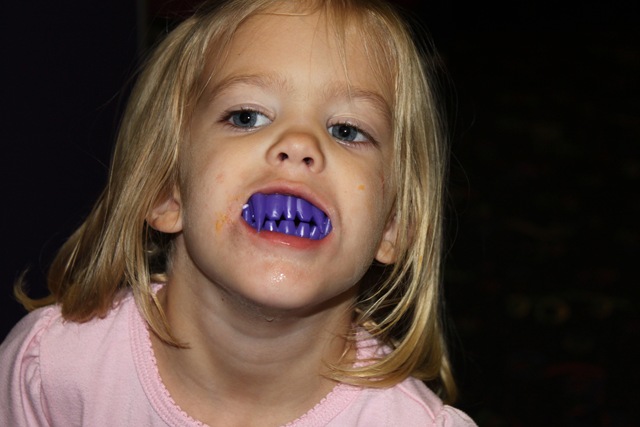 [vampireteeth925201062732PM3.jpg]