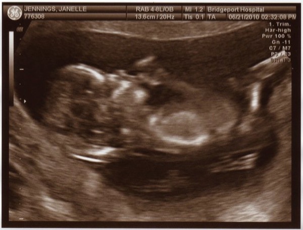 baby_ultrasound.jpg baby_ultrasound.jpg